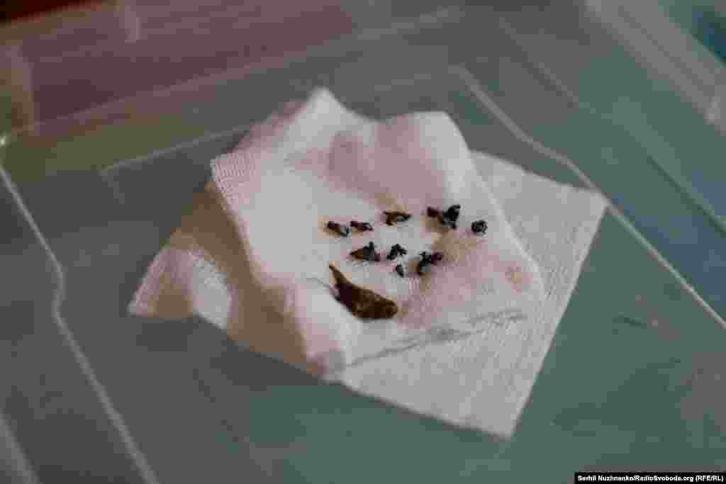 Аскепкі снарадаў, вынятыя зь цела параненага ў мэдыцынскай установе пад Аўдзееўкай, сакавік 2024&nbsp;