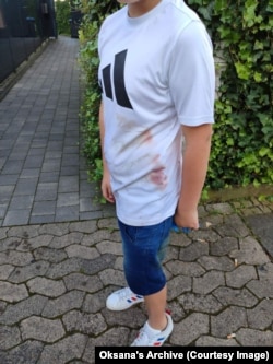 Після падіння в канаву 10-річний Даня отримав поранення