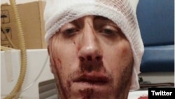 Napadnuti novinar Vladimir Kovačević