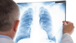 TƏBİB-in sistemində müəmmalı diaqnozlar: Saxta xəstəliklərlə pul silindiyi iddia edilir