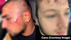 Пострадавшие от действий ОМОНа в самопровозглашенной Южной Осетии 