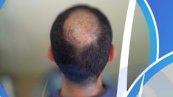 Жаңылыктар | 19.12.2025 | Түштүк Кореянын президенти чач түшүүгө каршы күрөш баштады
