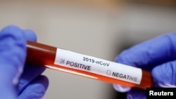 Test na korona virus